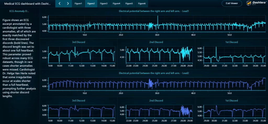 Medical-ecg-dashboard-with-dashtera-cardiologist-annotated-anomalies