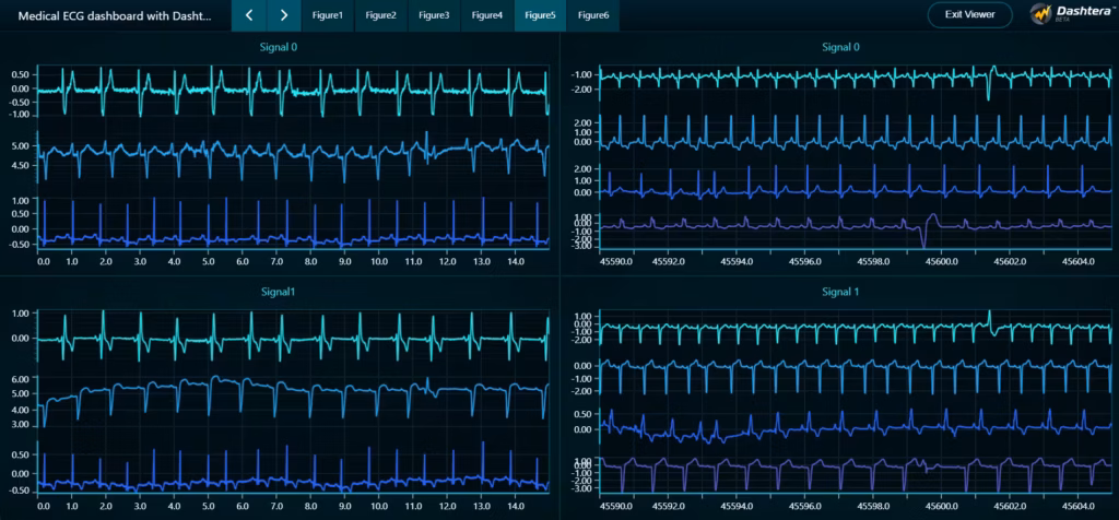 Medical-ecg-dashboard-with-dashtera-discord-scores