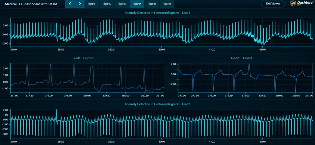 Medical-ecg-dashboard-with-dashtera-subsequence-comparison