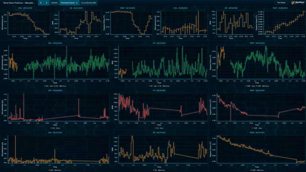 Nurse-stress-prediction-dashboard-signals