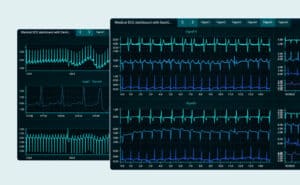 Medical ecg dashboard with dashtera some
